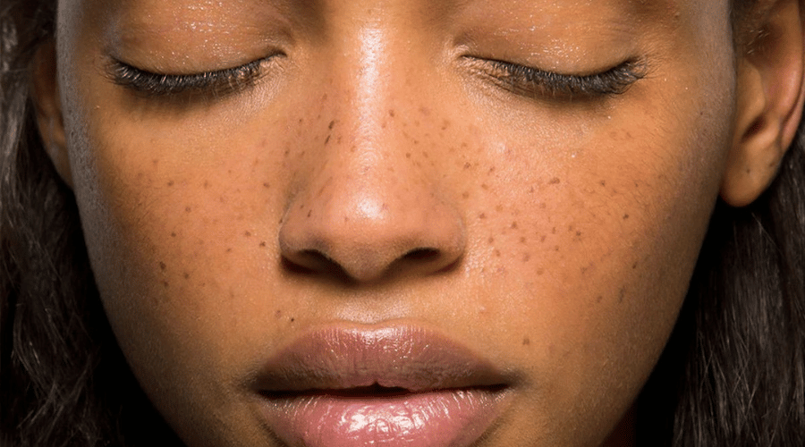 Faux freckles: sproeten zonder zon - Daily Beauty - Your skincare sidekick