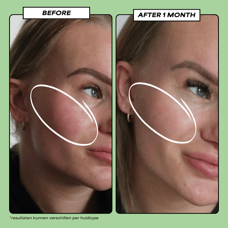 Translation missing: nl.Destress Calming Serum 30 ML - Daily Beauty - Your skincare sidekick
