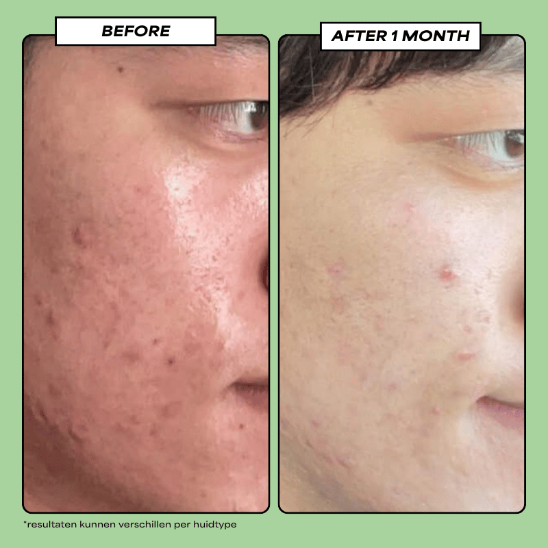 Translation missing: nl.Reverse Anti - Aging Serum 30 ML - Daily Beauty - Your skincare sidekick