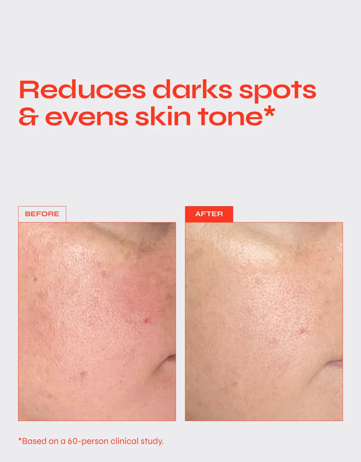 Translation missing: nl.Brighten Pigment Serum 30 ML - Daily Beauty - Your skincare sidekick