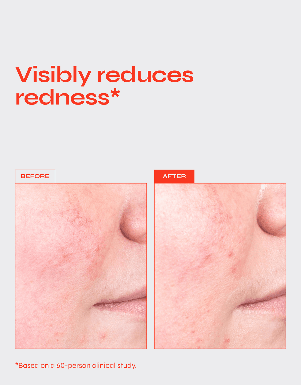 Translation missing: nl.Destress Calming Serum 30 ML - Daily Beauty - Your skincare sidekick