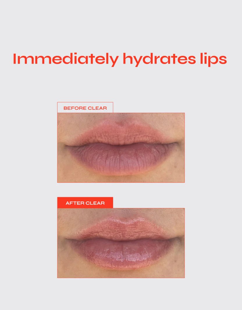 Translation missing: nl.Lip Jelly Clear 15 ML - Daily Beauty - Your skincare sidekick