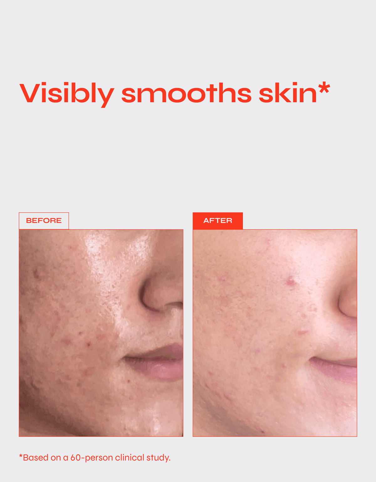 Translation missing: nl.Reverse Anti - Aging Serum 30 ML - Daily Beauty - Your skincare sidekick